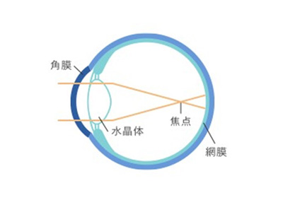 近視の状態