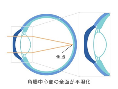 日中レンズ外した後