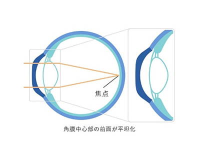 日中レンズ外した後